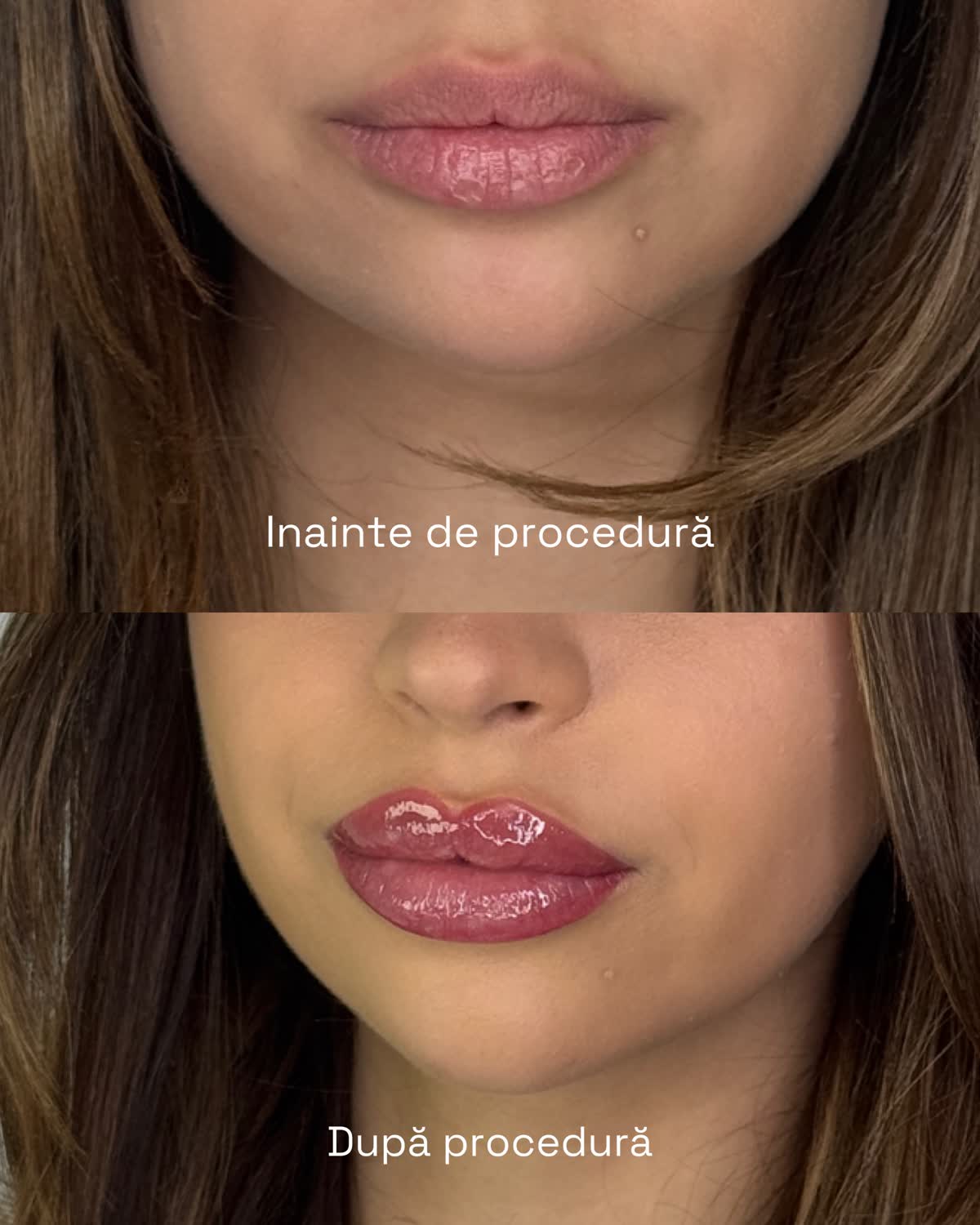 Lip blush – before after