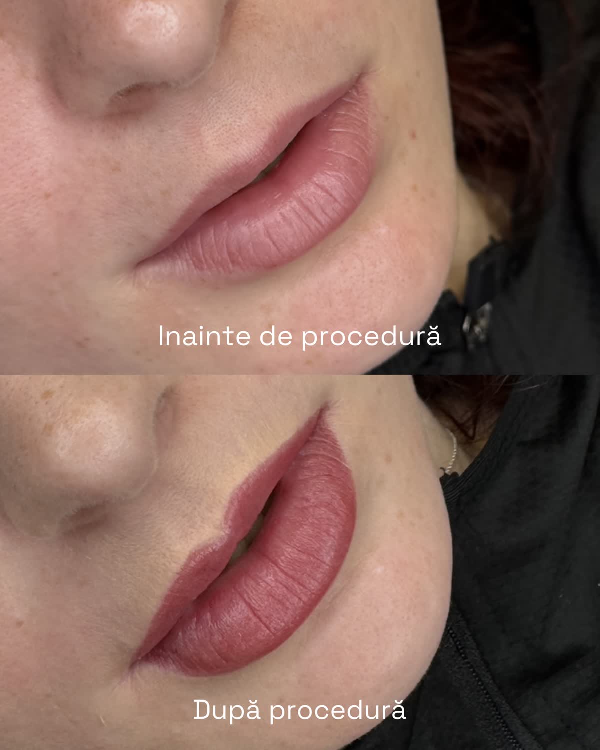 Micropigmentare buze – before after