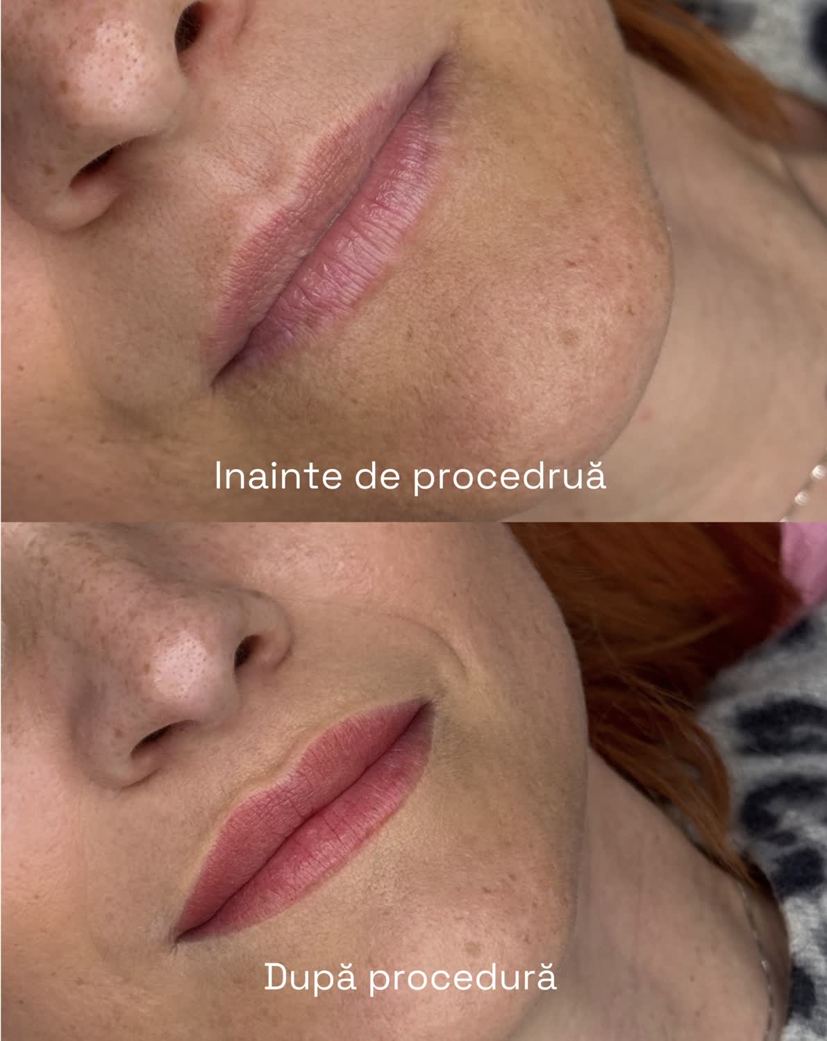 Micropigmentare buze – before after