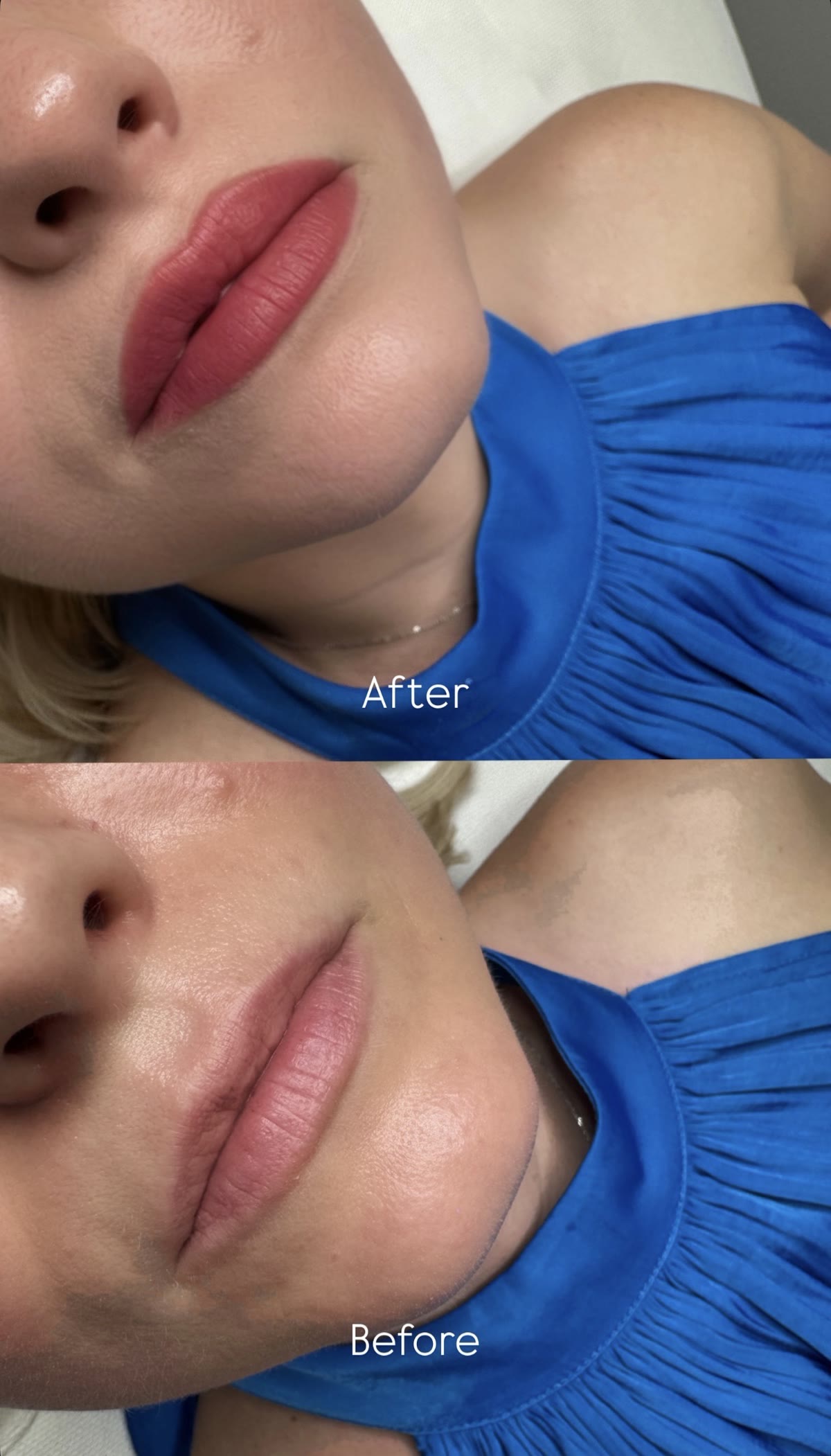Before & After – Lip Blush
